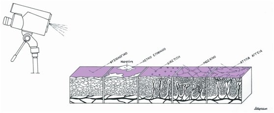 Atypical Transformation Zone – 1. Introduction