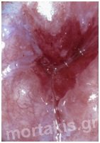cervix