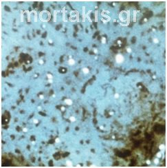 colposcopy