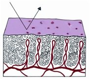 colposcopy