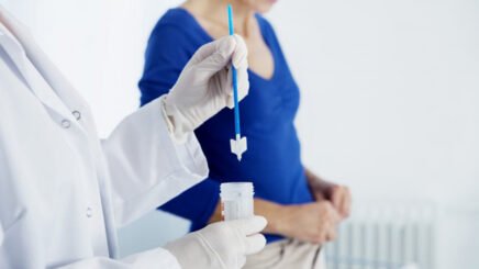 Liquid-based Pap test (Thin Prep)