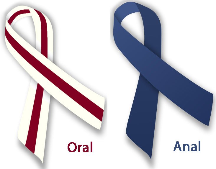 anal cancer