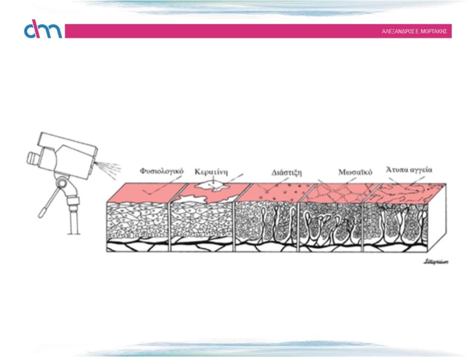 epithelium