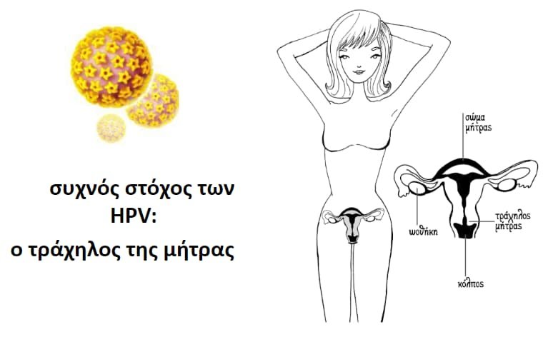 Καρκίνος τραχήλου της μήτρας: Συμτώματα & Αντιμετώπιση